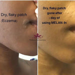 Melan-In Skin Nourishing Serum+ MPF - Natural Skincare